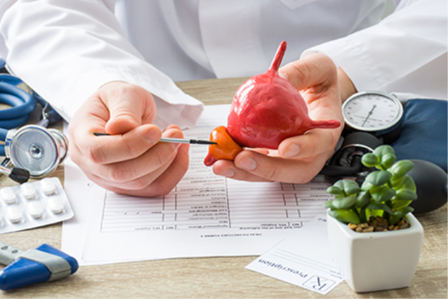 רופא מחזיק דגם של בלוטת הערמונית